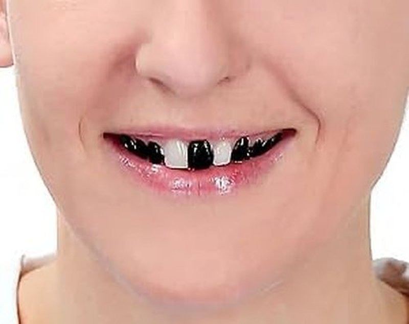 Go Ho Makeup Tooth SFX Black Paint,Temporary Black Teeth Paint,Safe,Quick Dry&Realistic,Perfect for Cosplay,Theater,Halloween Clown Skeleton Zombie Vampire Costume Makeup,5 ml