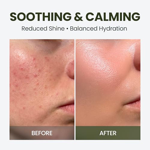 elravie HyCicaMue Defence Cream | Barrier Repair Moisturizer for Soothing, Recovery | Cica, Hyaluronic Acid, Vegan Mucin | Calming Sensitive Skin, Sebum Control, Boosting Hydration | Korean Skin Care