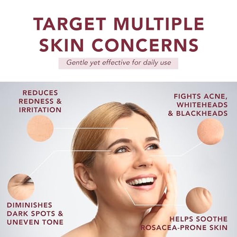 10% Azelaic Acid Serum with Niacinamide & Hyaluronic Acid – Rosacea Treatment For Face – Redness Relief, Blemish Relief, Brightening Skincare for Rosacea-Prone, Oily or Sensitive Skin, 30ml