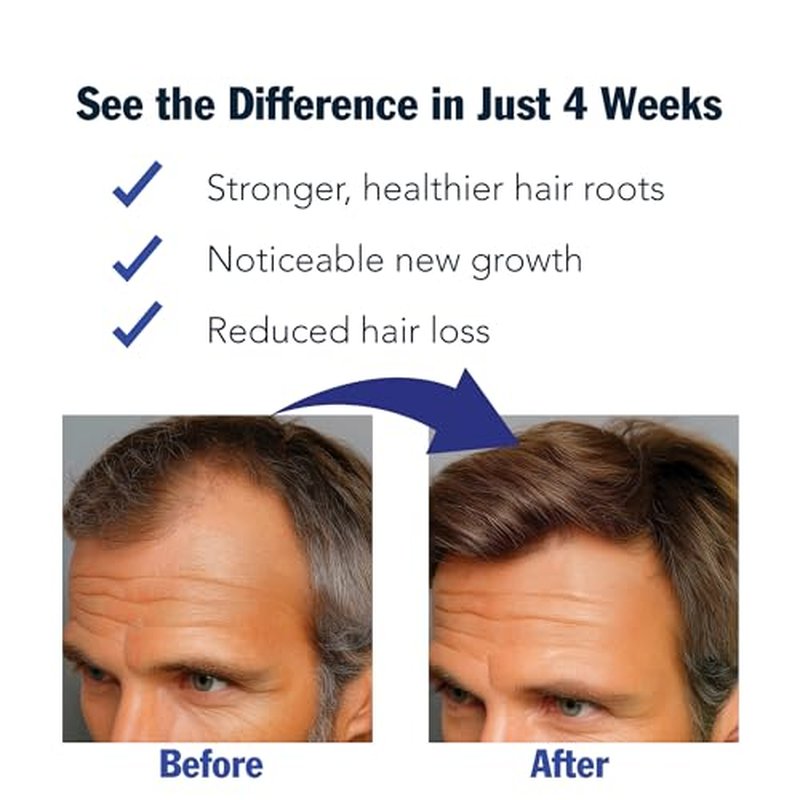 Puggaree Redensyl Hair–Growth–Serum Roll On – 3% Rosemary, 3% Redensyl, DHT-Blocking Scalp Serum for Thicker, Fuller Hair – For Women & Men (30 ml)