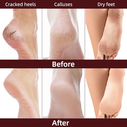 GUOYAOLIFU Hydrating Hand Foot Masks Set for Women Men,5 Pack Socks Mask for Dry Cracked Feet（Milk）