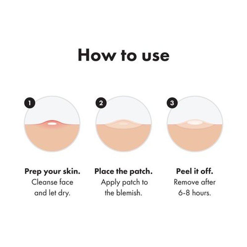 Mighty Patch™ Invisible+ Patch – The Barely-There Daytime Hydrocolloid Acne Pimple Patch for Covering Zits and Blemishes, Tapered Edges Designed to Blend Into Skin (72ct)
