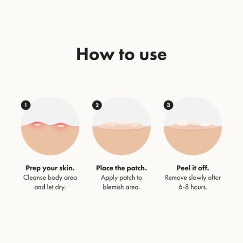Mighty Patch Hero Cosmetics Body Patch– The XXL Hydrocolloid Patch for Bacne, Chestne, and Other Body Breakouts. Derm-Tested. Medical-Grade Hydrocolloid. Absorbs Pimple Gunk in 6-8 Hours. 4ct