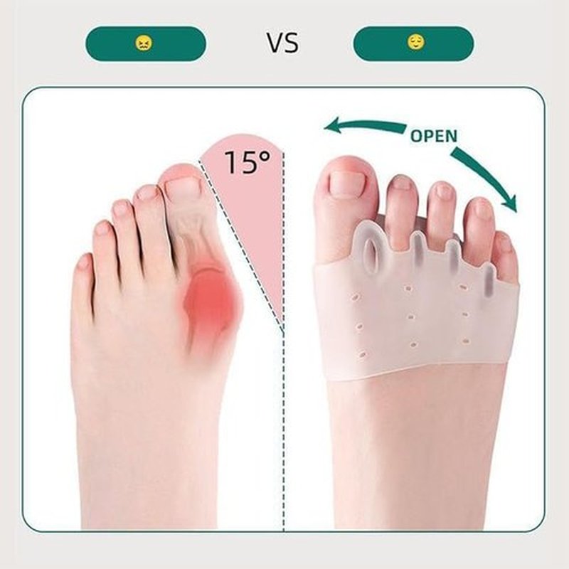2025 New Silicone Toe Separators 4 Pairs Bunion Corrector Bunion Corrector Cushion, Metatarsal Pads for Men Women Straighten Overlapping Toes, Realign Crooked Toes