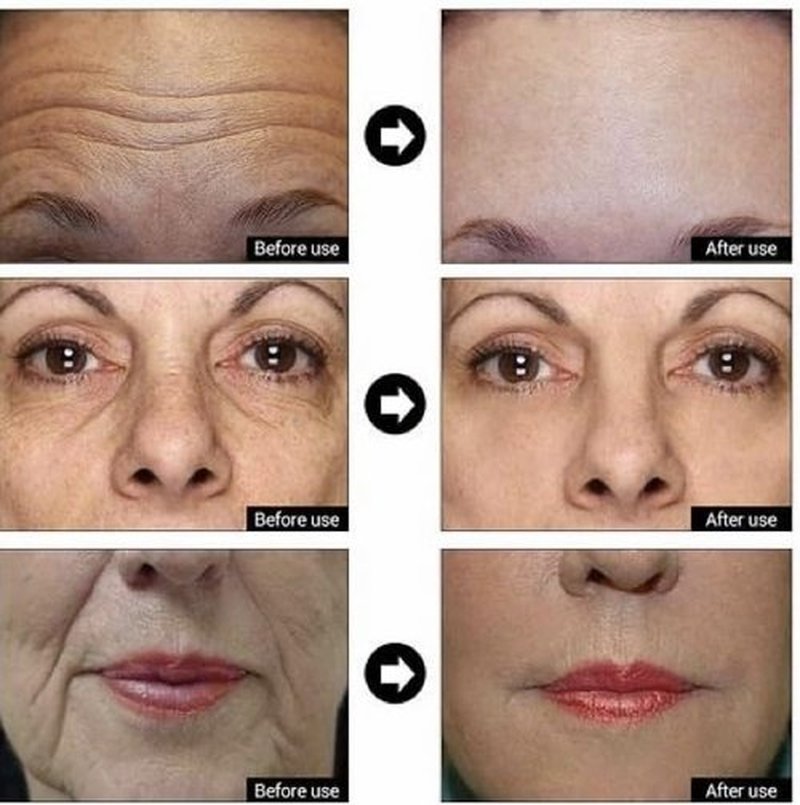 Matrixyl 3000 + Argireline, Vitamin C, Hyaluronic Acid Serum, Anti-Aging Face Serum, Anti-Wrinkle Serum for face, Multi Peptide Firming Serum - 8oz