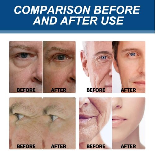 Skiennix 6-in-1 Face Cream for Men - Anti-Aging Moisturizer with Collagen & Hyaluronic Acid, 1.76 fl oz