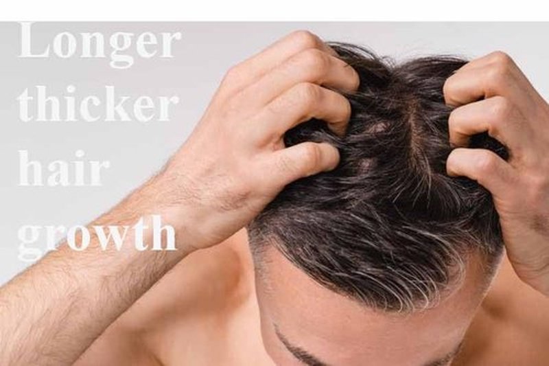 Super Growth DHT Blocker Cream - Promote Healthy Hair Growth | 4 oz