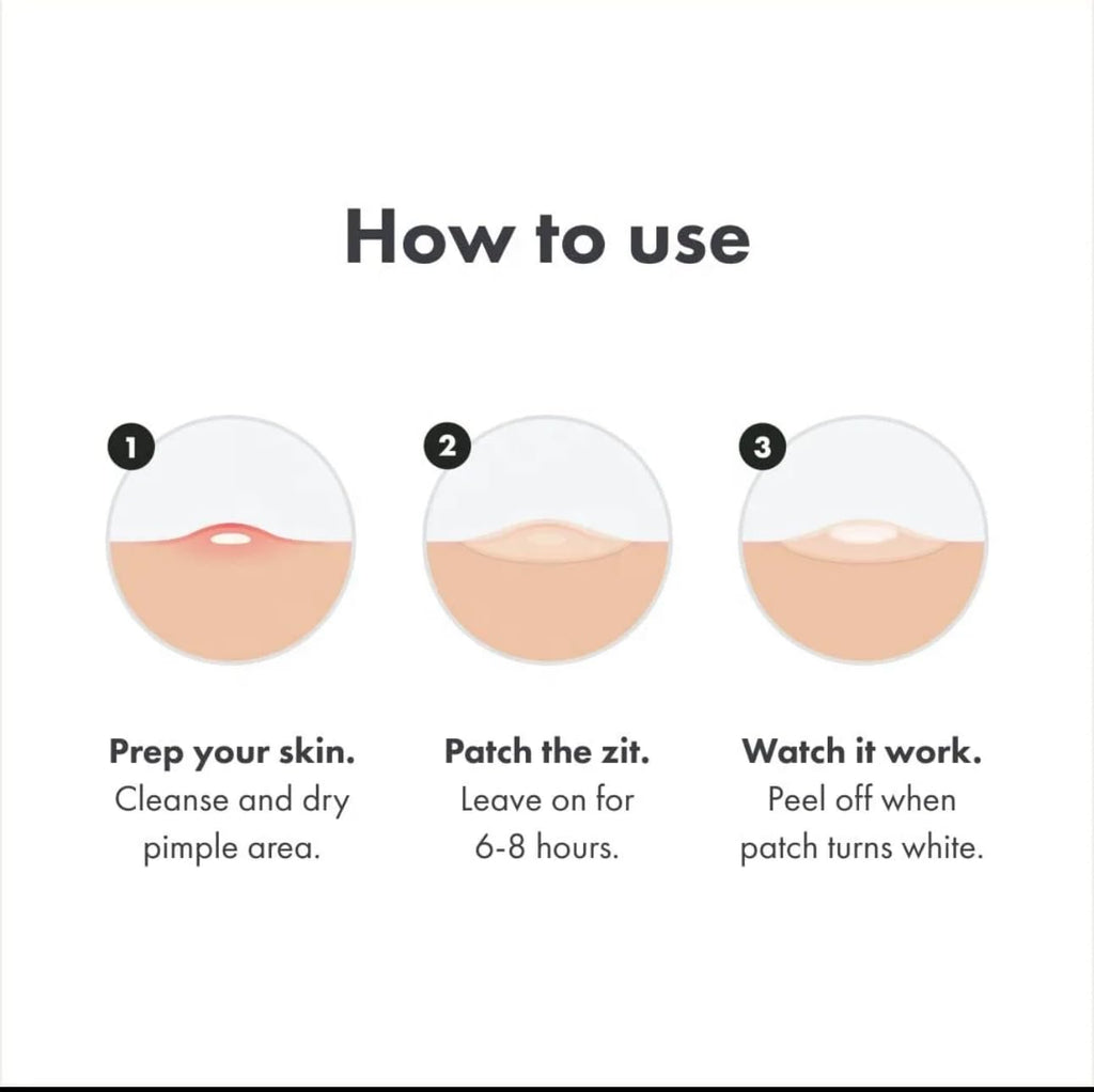 kisskin ZitZap Pimple/Acne Patches For Face And Skin, Hydrocolloid Patches With Salicylic Acid And Tea Tree Oil For Covering Zits And Blemishes.
