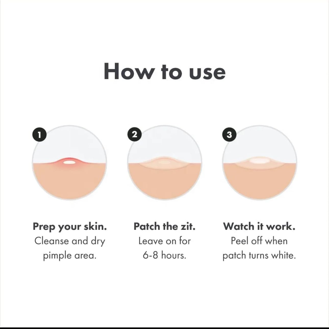 kisskin ZitZap Pimple/Acne Patches For Face And Skin, Hydrocolloid Patches With Salicylic Acid And Tea Tree Oil For Covering Zits And Blemishes.