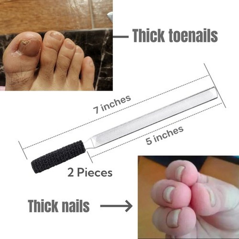 IDOU 2-Piece Stainless Steel Toenail File for Thick Nails | 4-Sided Design with Non-Slip Grip & Thumb Protector | 7" Durable Metal Nail File for for All, Elderly & Dogs