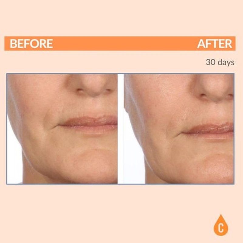 Serious Skincare - Serious-C3 Plasma Vitamin C Restore - Restoration Night Cream for Deep Hydration - Hydrolyzed Collagen - Hydrating Moisture for Face and Neck - 1.7 oz.