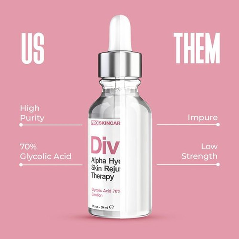 Glycolic Acid Peel 70% - Professional At-Home Chemical Peel for Acne Scars & Wrinkles | Intense Liquid Exfoliant