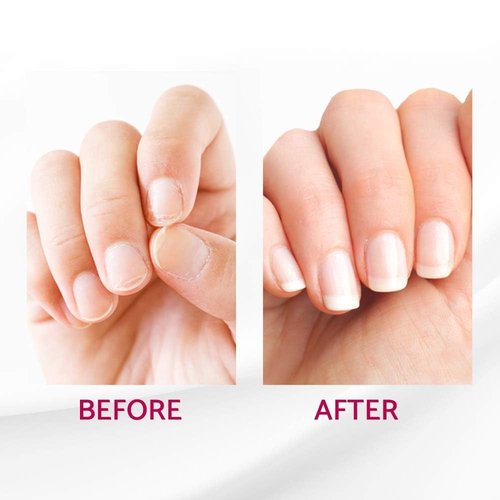 IBD Reconstrux Nail Repair Treatment – Nail Strengthener for Weak & Damaged Nails, Nail Growth Treatment for Peeling & Brittle Nails – 0.125 fl oz, 2 Pack