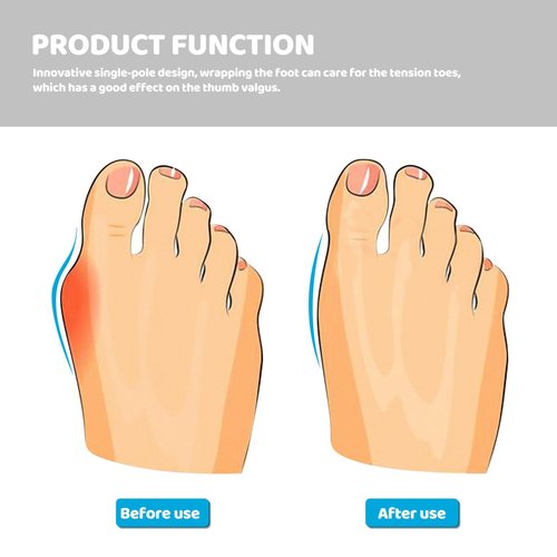 Flower Silicone Toe Separators for Women, Pedicure Toe Spacers Nail Separators for Comfortable Manicure and Nail Polish Application Reusable Dividers for Home and Salon Use