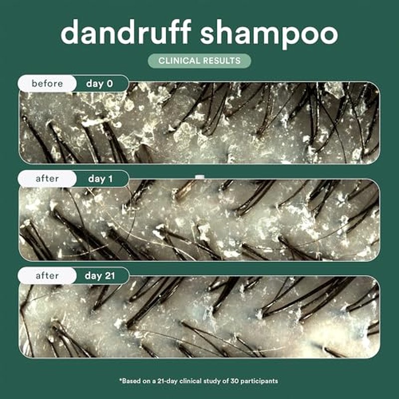 VERB® Dandruff Shampoo - for Gentle Cleansing and Clinical Strength Dandruff Relief with 3% Salicylic Acid, 8 oz