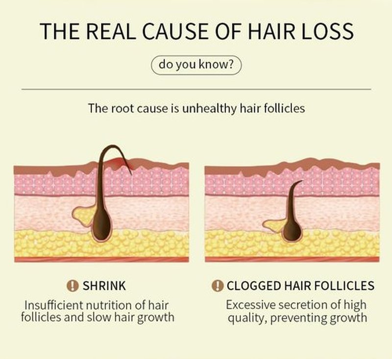 180 ML EELHOE Hair Growth Oil, Natural Rosemary Hair Growth Oil for Dry Damaged Hair and Growth Thin Hair. (3Pcs)