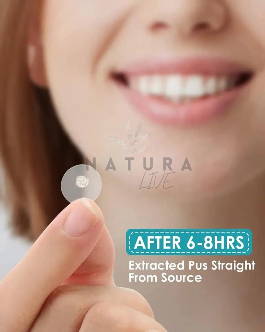 Natura Live Hydrocolloid Acne Patches – 120-Pcs Pimple Patches for Face –Blemish Patches to Cover Zits, Acne, Breakouts – Vegan and Cruelty-Free Zit Stickers – Zit Absorbing Acne Spot Dots