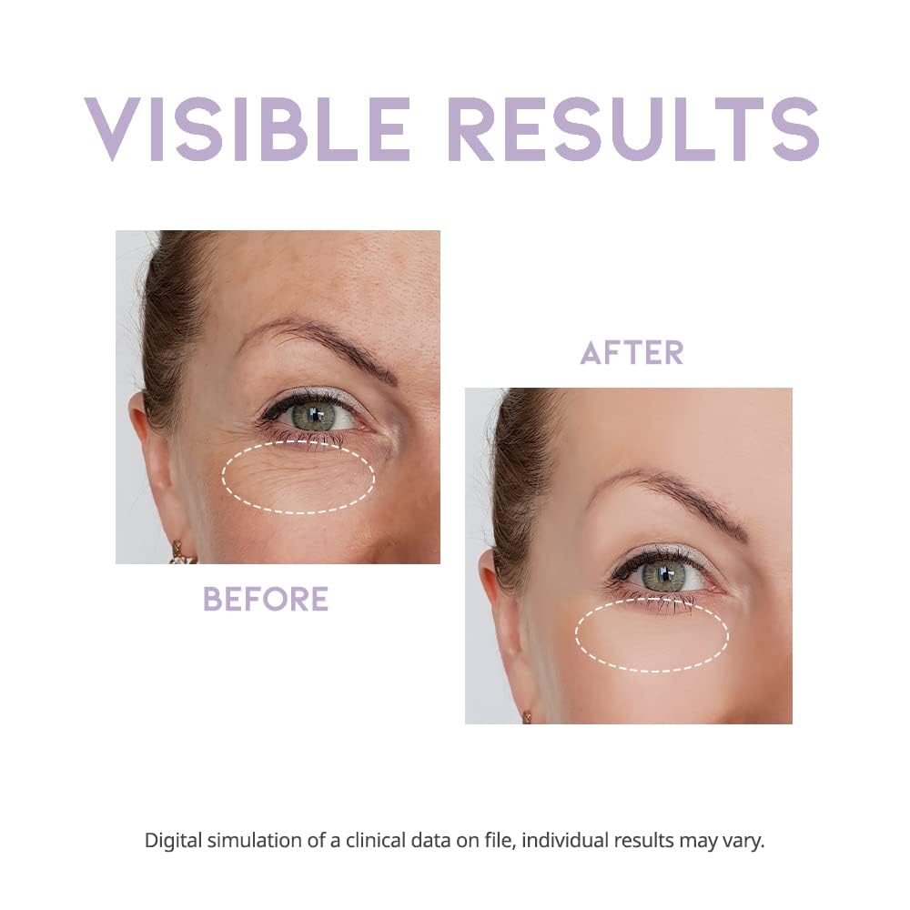 Korean Eye Cream for Dark Circles and Puffiness, Wrinkle-Smoothing Under Eye Cream with Peptide, Vitamin C & Collagen, Vegan Eye Care (25g)
