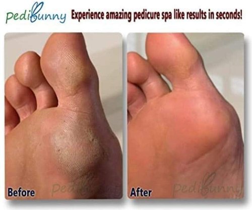 Electric Foot Callus Remover - Rechargeable Electronic Foot File - Professional Pedicure Tools with 3 Rollers - Foot Scrubber for Dry Cracked Feet and Dead Skin - Foot Sander for Men and Women