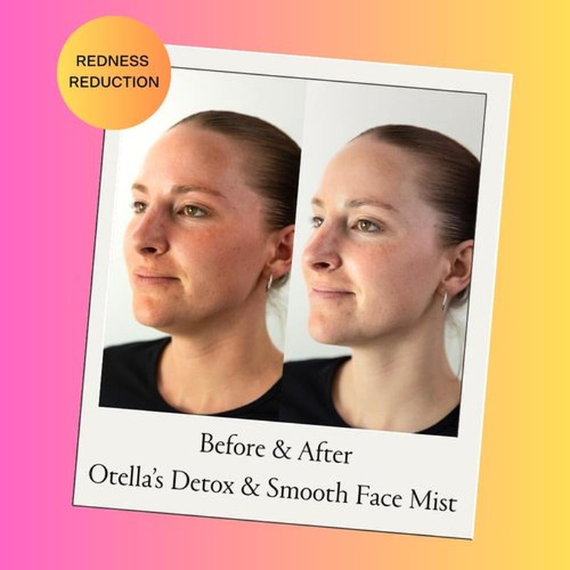 Otella Detox & Soothe Face Mist with Hypochlorous Acid .02% | 2.7 oz | Helps Reduce Redness, Irritation, Breakouts | Rosacea, Eczema, Sensitive-Skin Safe | Barrier Protecting & Skin Cleansing Toner