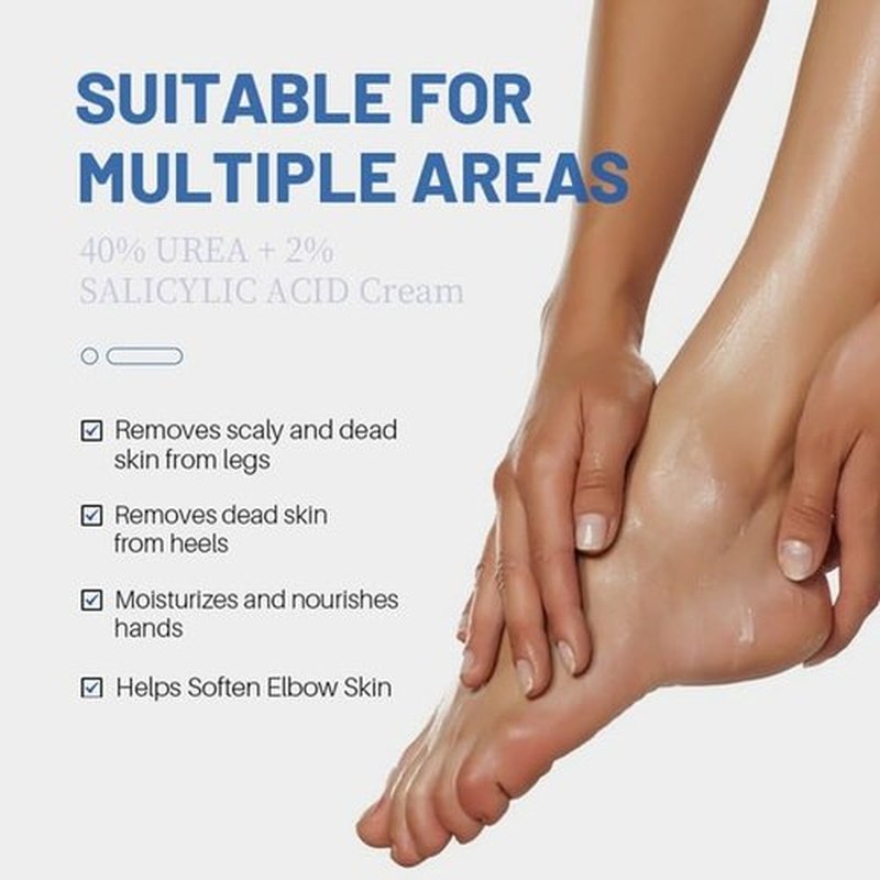 Advanced Urea Foot Cream 40% plus 2% Salicylic Acid for Cracked Heels and Dry Skin, 150gms/5.3oz with Tea Tree, Coconut Oil and Aloe Vera Extract for Deep Moisturizing Callus Removal