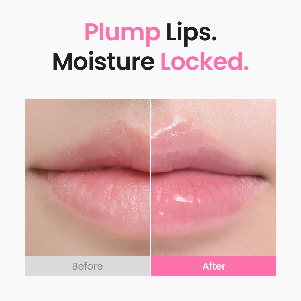 [SKIN&LAB] 3D PDRN X Collagen Lip Serum, Contains PDRN, Bakuchiol, Collagen, Plumping Effect, Smooth & Bouncy Lips, Deep Hydration, Mothers day, gift for mom – 0.35 fl. oz