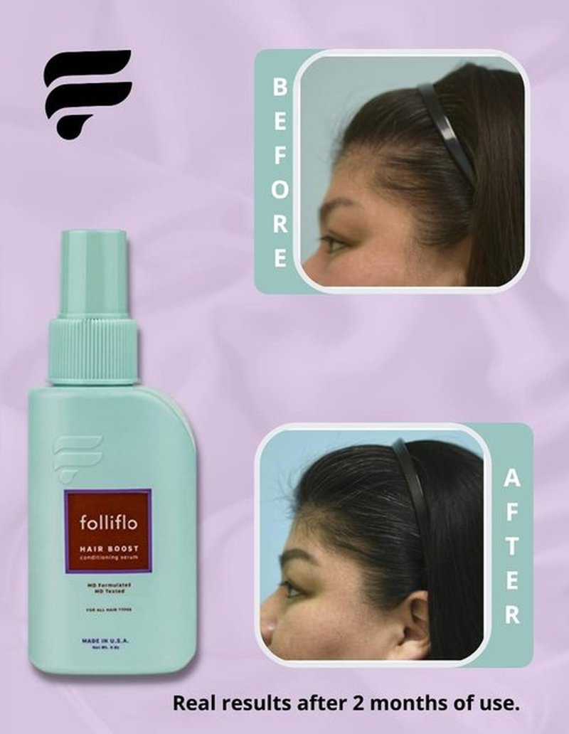 Folliflo Hair Boost Leave-In Conditioner Spray - Lightweight Serum for Thicker Hair | 90-Day Supply