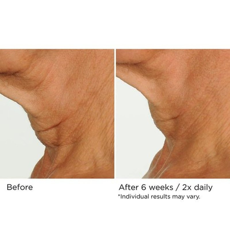 NassifMD Neck & Decollete Firming Complex - Lifting Treatment for Youthful Skin