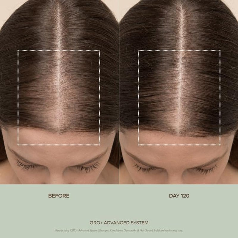 VEGAMOUR GRO+ Advanced Balancing Conditioner | Hydrates the Scalp, Nourishes and Softens Hair | For Severe Signs of Thinning | Color Safe, Vegan, Cruelty-Free, Formulated Without Silicones (8 Fl Oz)
