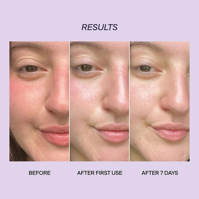 Provence Beauty BARE LUMIÈRE Skin Barrier Repair Cream – 5-in-1 Face Moisturizer with Ectoin, Encapsulated Probiotics & Aloe Vera – Hydrates, Primes, Boosts Glow & Strengthens the Skin – 2 fl oz
