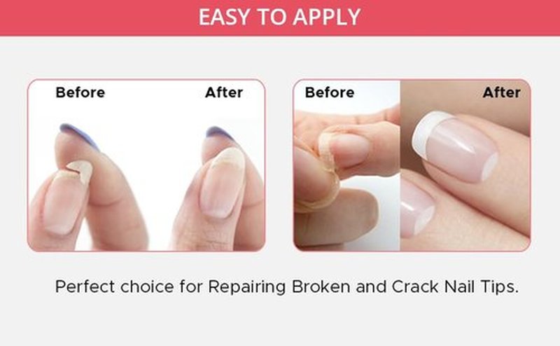 Professional Nail Repair Kit for Broken Cracked Split and Weak Nails. Easy to Use and Apply. Life saver nail Kit for Quick Fix Solution.
