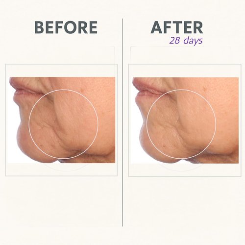 Serious Skincare Reverse Cream In-Tense | Firming Facial Moisturizer for Lifted Skin - 1.7 oz