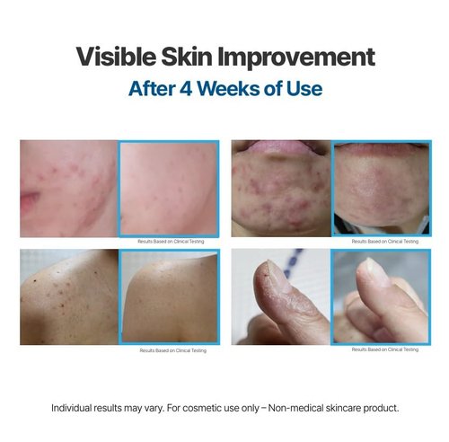 NOVADERM PEPTIDE THERAPY PRO-RESOLVING CREAM