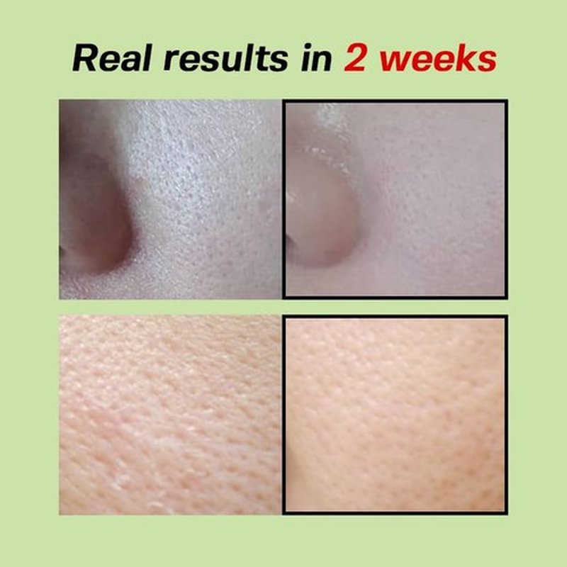 SUNGBOON EDITOR Green Tomato Pore Lifting Ampoule | Pore Minimizer Serum with Niacinamide & Green Tomato Extract | Hydrating & Firming Care for Sensitive Skin | Korean Skincare