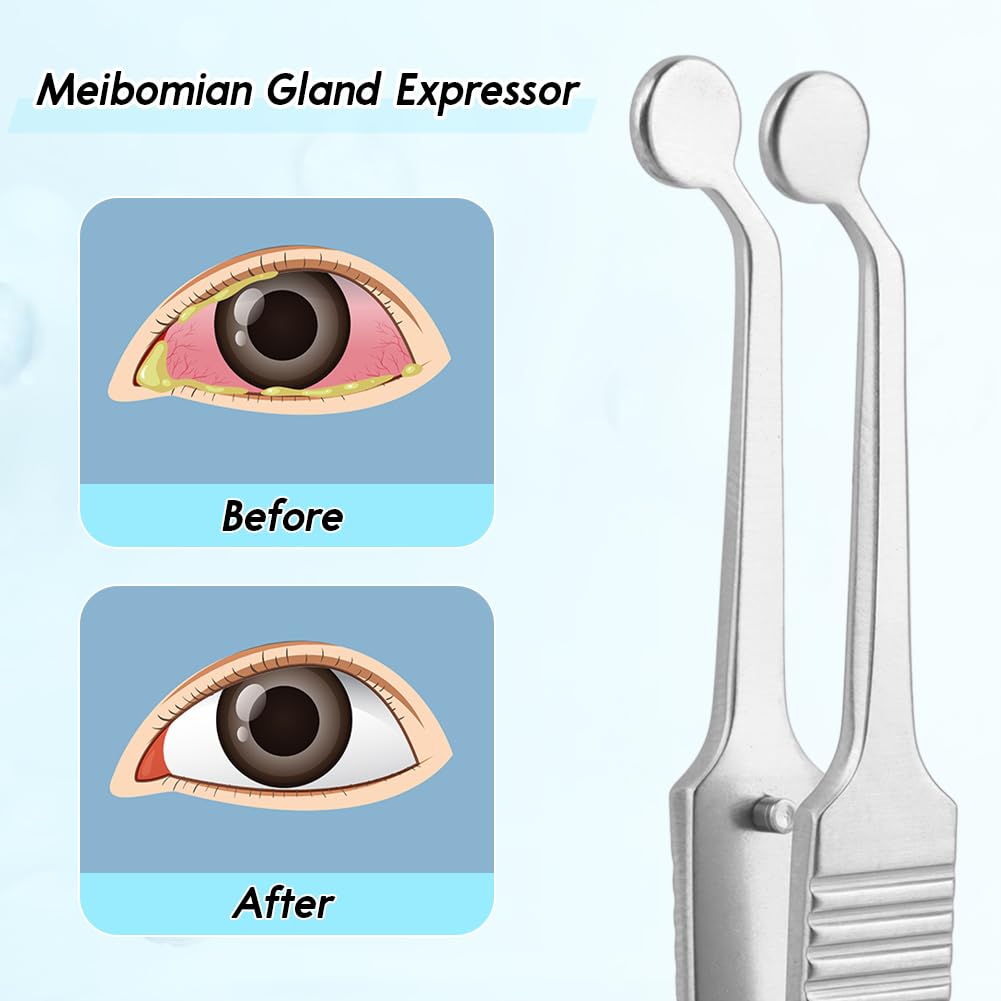 Meibomian Gland Expressor, Stainless Steel Round Tip Tweezers, Professional Non Slip Forceps Eyelid Massage Tweezers Eyelid Gland Care for MG Issue Dry Eyes - Easy to Use