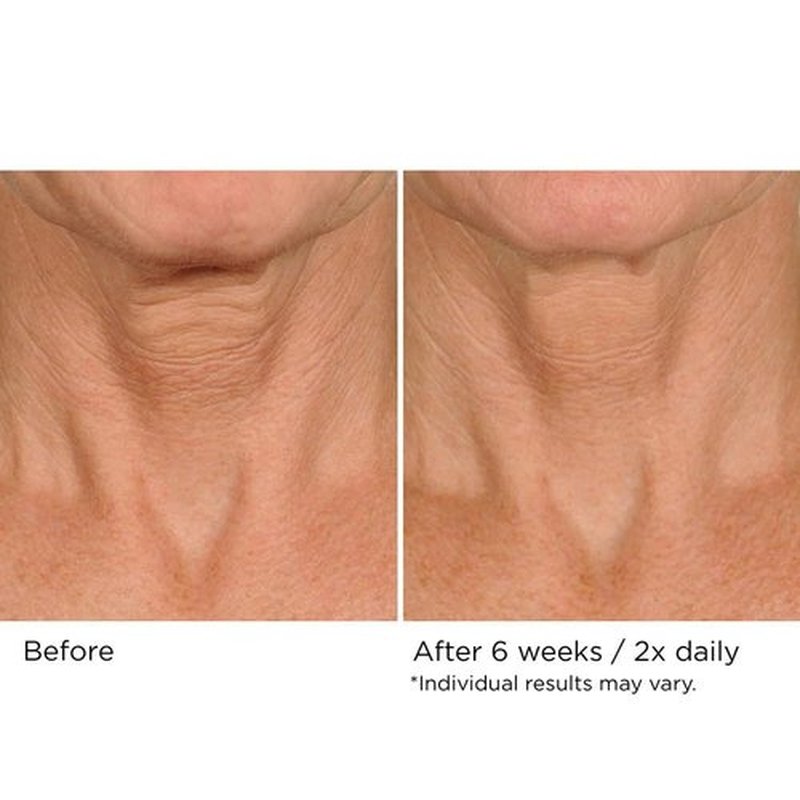 NassifMD Neck & Decollete Firming Complex - Lifting Treatment for Youthful Skin