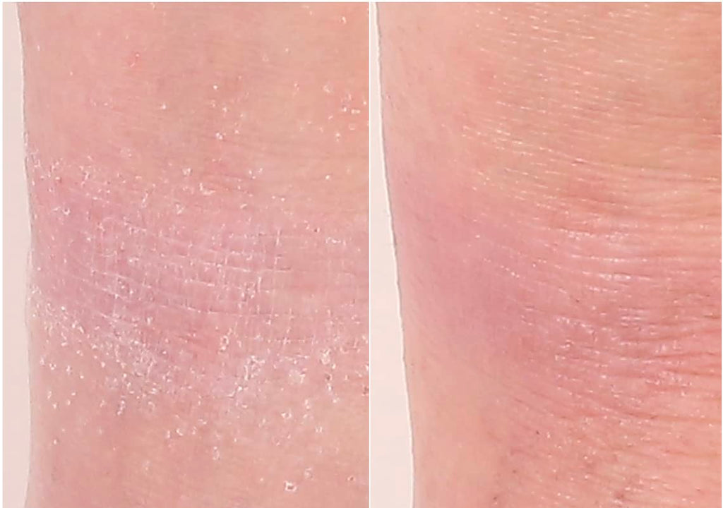 Nakery Intensive Repair Treatment Eczema Relief Soothing Cream for Face & Body | 2% Colloidal Oatmeal | Immediate Relief