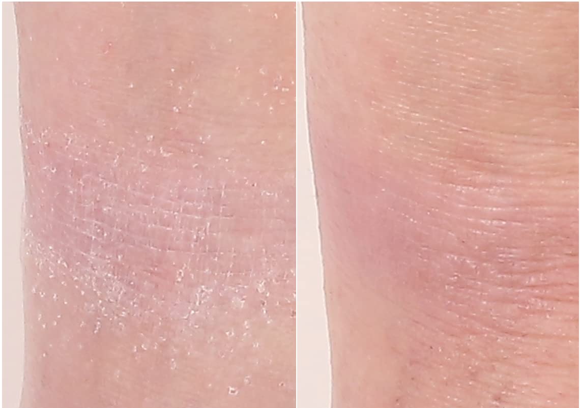 Nakery Intensive Repair Treatment Eczema Relief Soothing Cream for Face & Body | 2% Colloidal Oatmeal | Immediate Relief