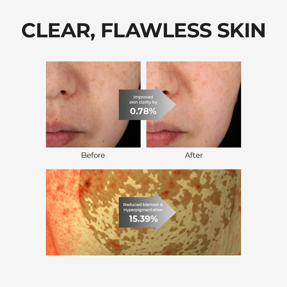 [Skin&LAB] Glutathione Ampoule Toner 6.76 fl oz, Improve Dart Spot, Hyperpigmented, Skin Clarity, Korean Toner for Sensitive Skin