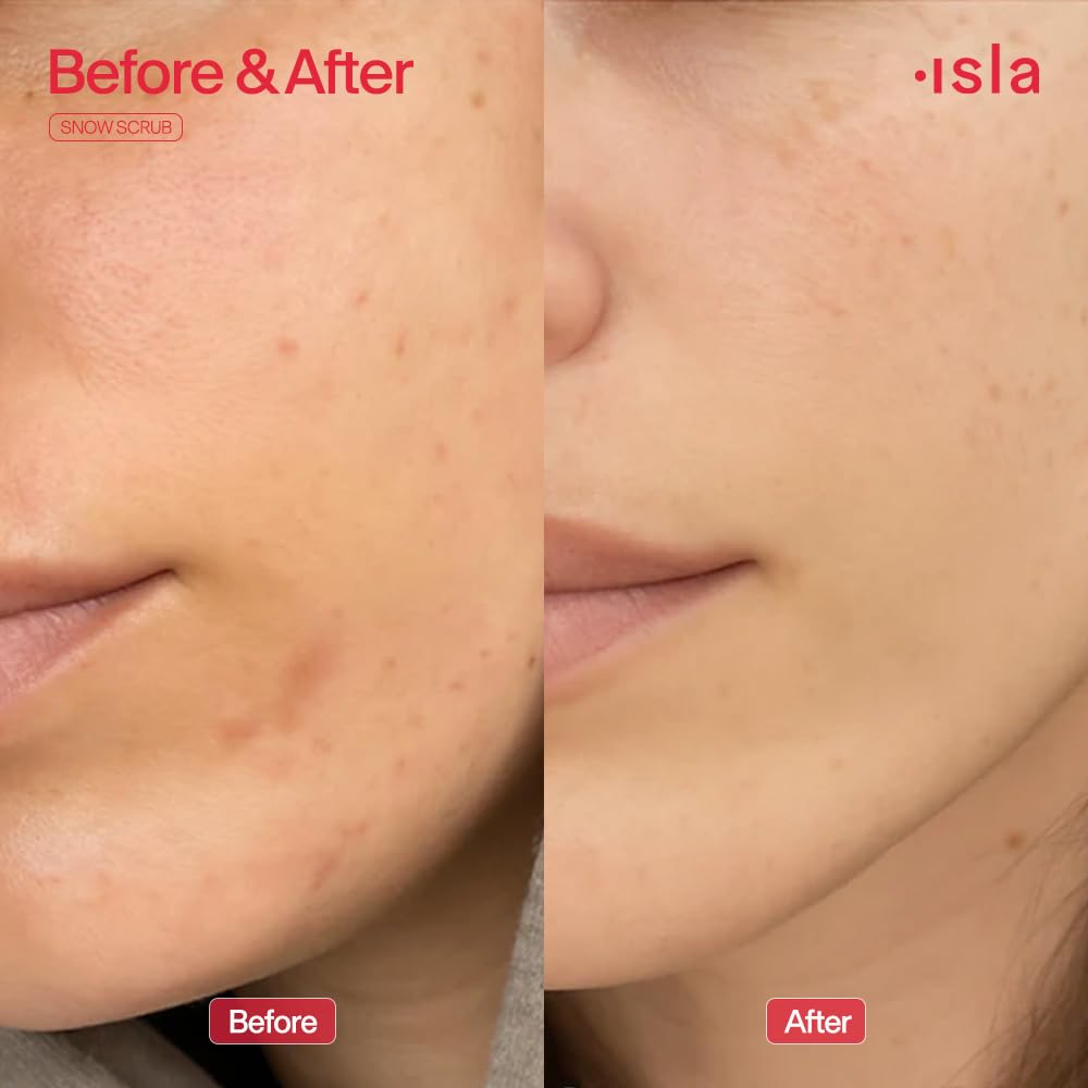 ISLA Beauty Women's Snow Scrub Exfoliator