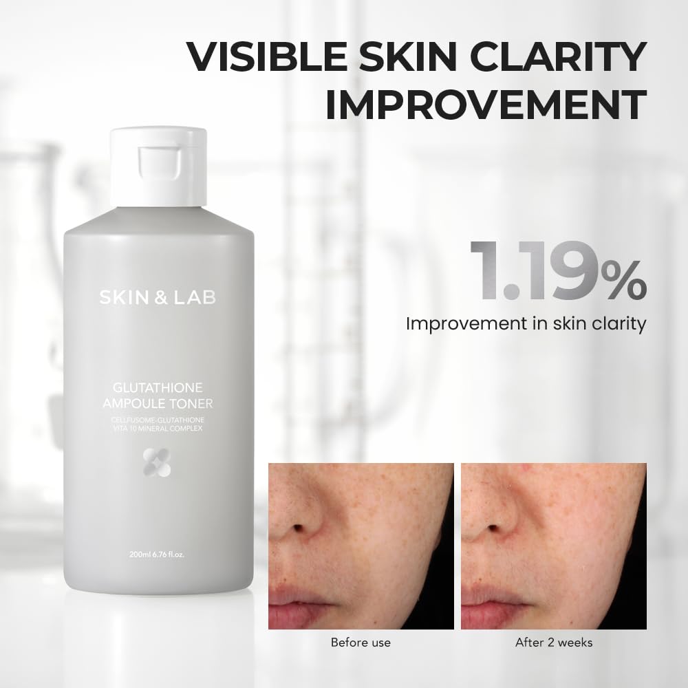 [Skin&LAB] Glutathione Ampoule Toner 6.76 fl oz, Improve Dart Spot, Hyperpigmented, Skin Clarity, Korean Toner for Sensitive Skin