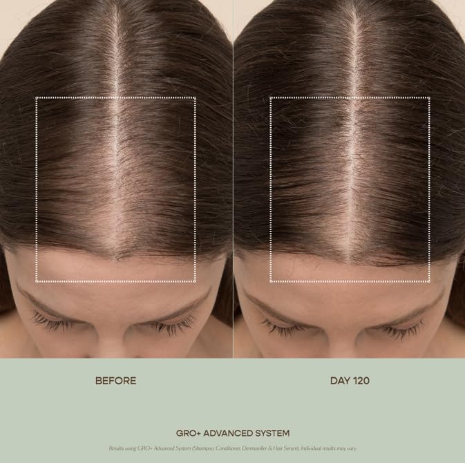 VEGAMOUR GRO+ Advanced Hair Serum for Improving Hair Density, Tonic Reduces Shedding and Promotes a Healthy Scalp, 1 pack