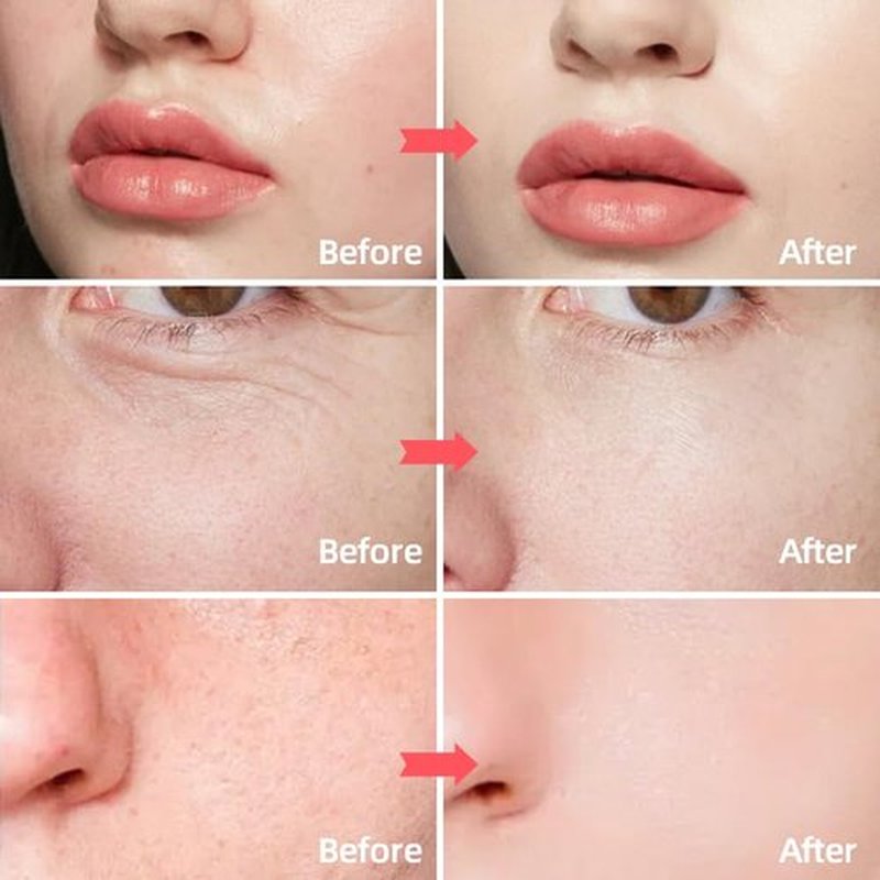 SORYA Advanced Anti-Aging Retinol Cream with Collagen & Hyaluronic Acid – Deeply Hydrating & Firming Face Moisturizer – Helps Improve the Look of Fine Lines & Wrinkles – For Smooth, Radiant Skin