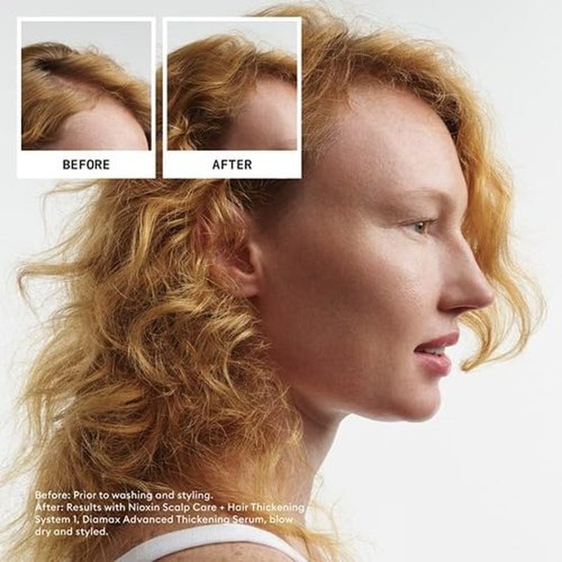 Nioxin Scalp + Hair Thickening System Kits - Strengthen Natural, Colored & Damaged Hair | 3 Month Supply with Niacinamide & Biotin