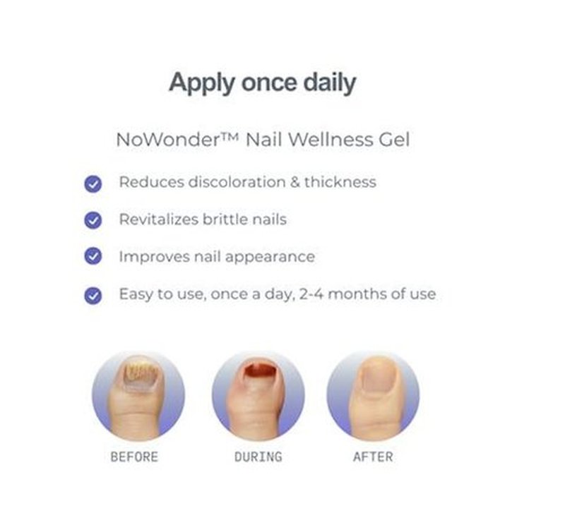 NoWonder Nail Wellness Gel - Nitric Oxide Nail Renewal Solution for Healthier, Clearer Nails | Easy-to-Use