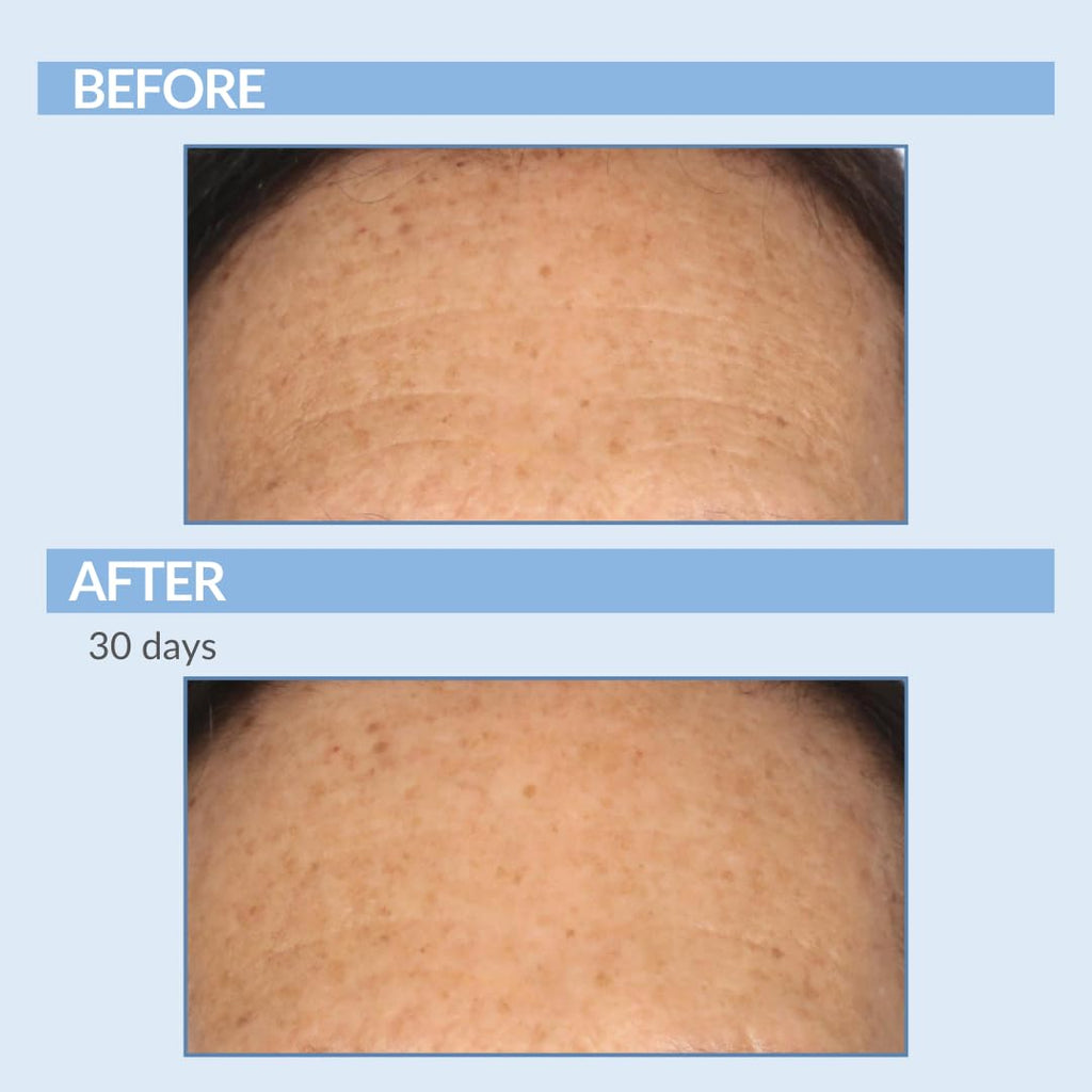 Retinol Exfoliation Treatment Pads for Smoother Skin - Retinyl Palmitate, Vitamin A - Daily Skin Resurfacing for Pore Care - Reduces Fine Lines and Wrinkles - Serious Skincare - 60 Count (2Pack)