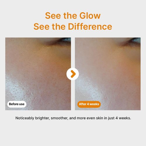 Pure Vitamin C Serum - Brightening Korean Skincare with 10.5% Vitamin C | Waterless Airless Pump, 30ml