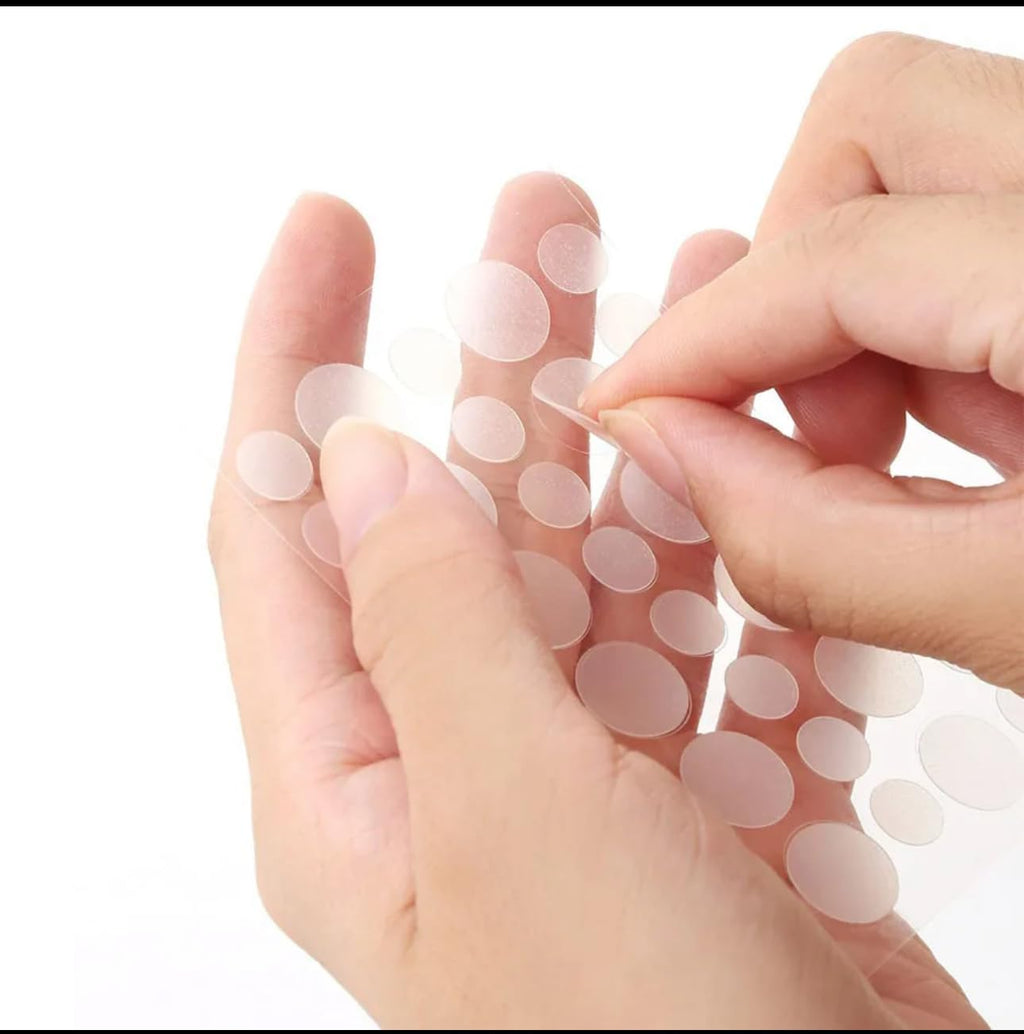 kisskin ZitZap Pimple/Acne Patches For Face And Skin, Hydrocolloid Patches With Salicylic Acid And Tea Tree Oil For Covering Zits And Blemishes.