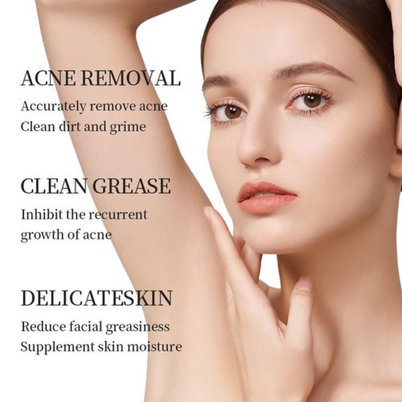 Azelaic Acid Acne Treatment Cream - 20% Glycolic Acid & Hyaluronic Acid, Oil Control, 20g
