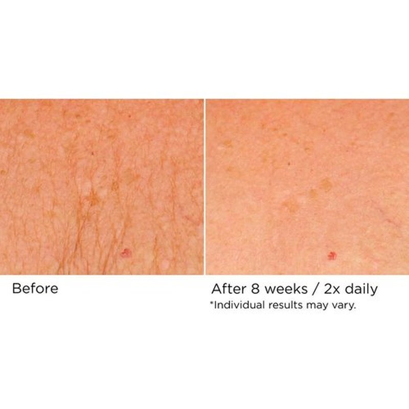 NassifMD Neck & Decollete Firming Complex - Lifting Treatment for Youthful Skin